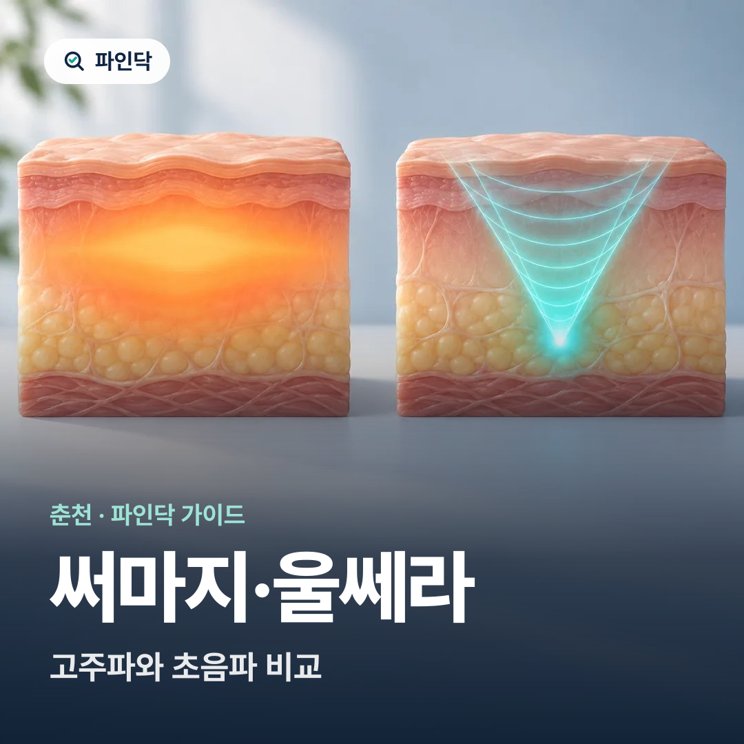 써마지·울쎄라 — 고주파와 초음파 비교